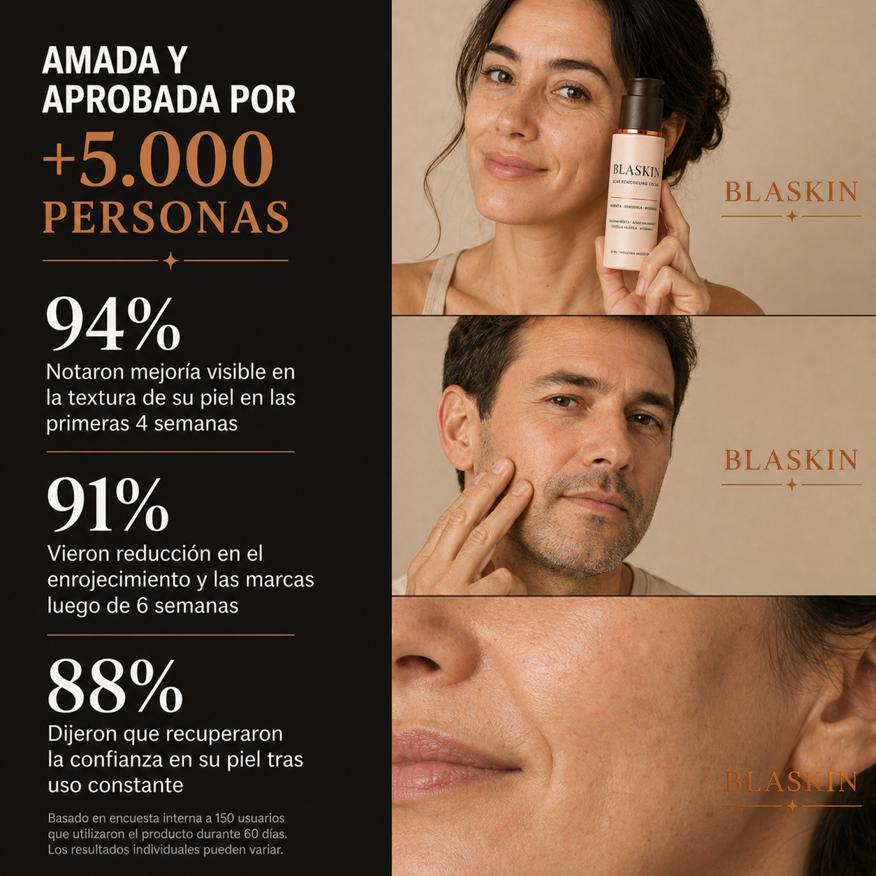 BLASKIN Crema Remodeladora de Cicatrices de Acné - 50ml