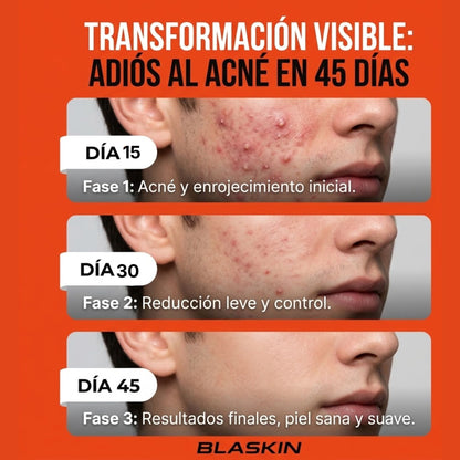 BLASKIN Spray Facial  Control Piel Masculina