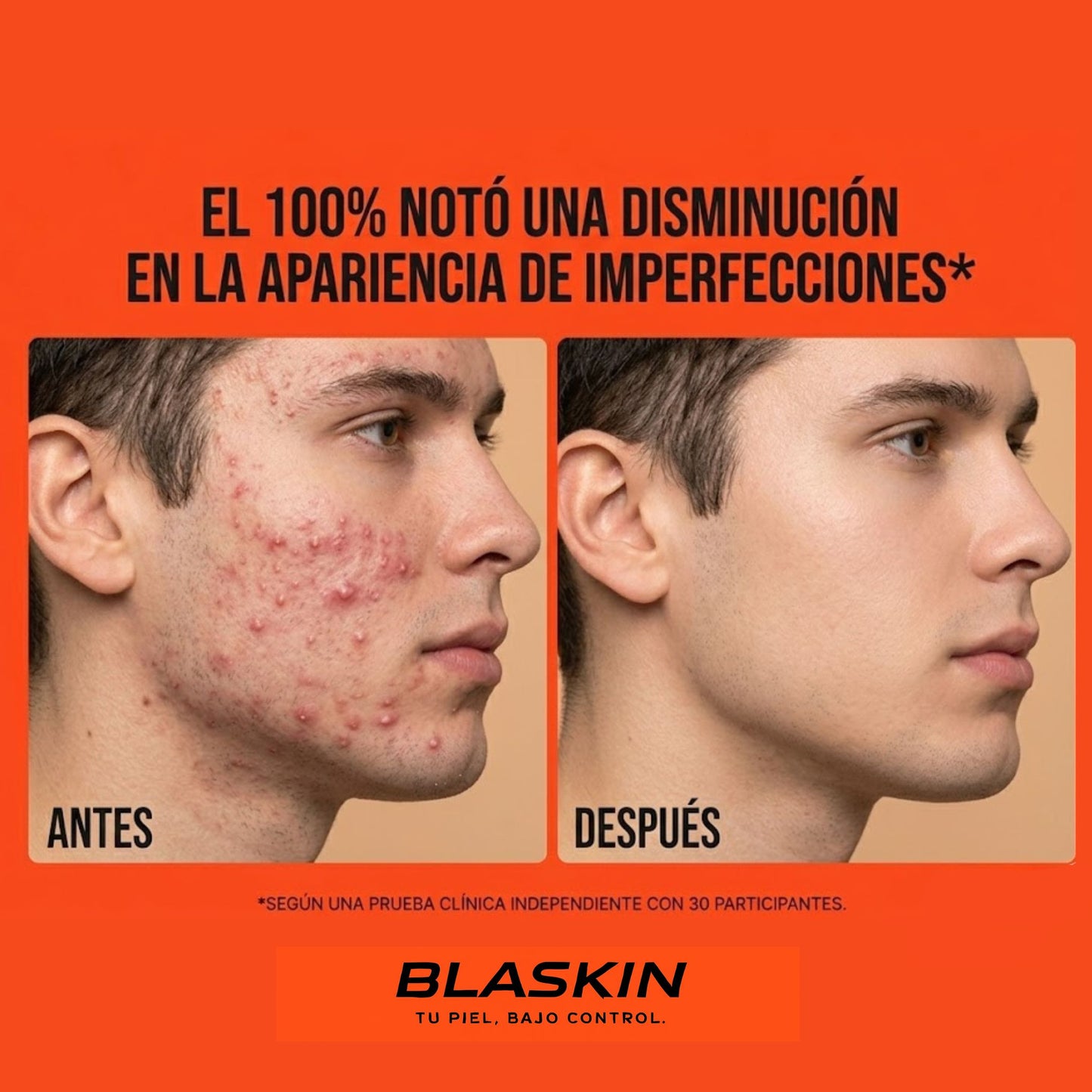 BLASKIN Spray Facial  Control Piel Masculina