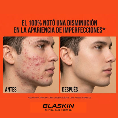 BLASKIN Spray Facial  Control Piel Masculina