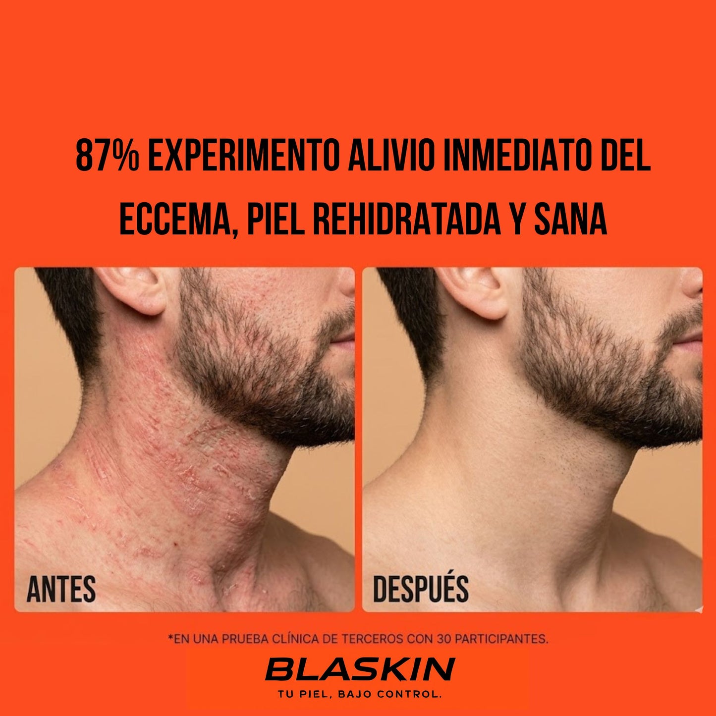BLASKIN Spray Facial  Control Piel Masculina